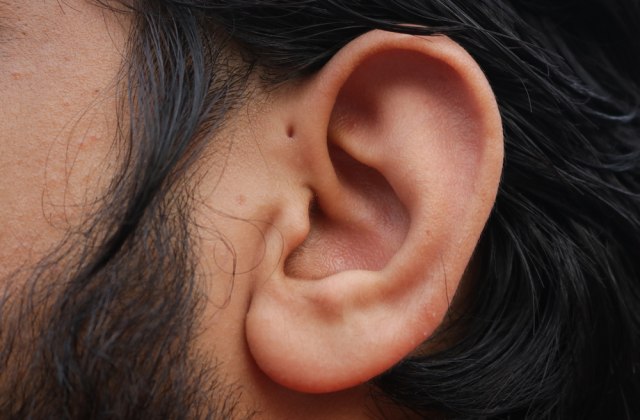 Retka pojava koju možete da nasledite i treba da se prati ceo život – pogledajte svoje uši